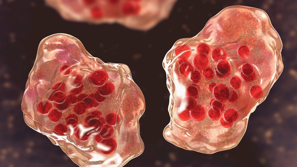 Central Minnesota county reports "several cases of suspected measles" — WCCO / CBS Minnesota, Robbinsdale Health news