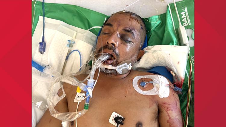 University Hospital asks for help identifying unconscious patient hit by truck Saturday evening — KENS 5 (San Antonio), Robbinsdale Health news