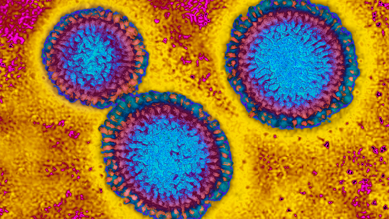 Flu hospitalizations 'slightly higher' than usual, officials urge vaccinations — FOX 9, Robbinsdale Health news